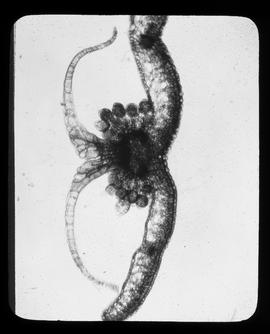 Aspidium filix mas (Dryopteris), Wurmfarn, Blattquerschnitt mit Sorus, Schleier und Sporangien